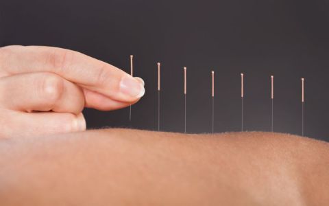 Image for 1. Acupunctuur